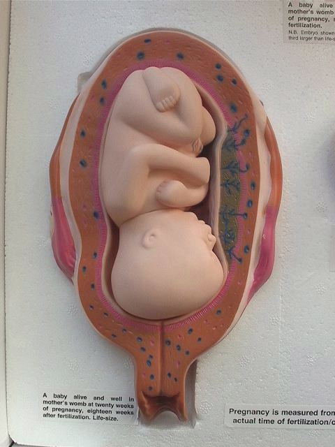 Fetal Model--20 weeks